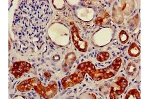 Immunohistochemistry of paraffin-embedded human kidney tissue using ABIN7153147 at dilution of 1:100 (FXR1 抗体  (AA 469-614))