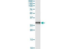 Immunoprecipitation of LIN28 transfected lysate using anti-LIN28 MaxPab rabbit polyclonal antibody and Protein A Magnetic Bead , and immunoblotted with LIN28 purified MaxPab mouse polyclonal antibody (B01P) . (LIN28A 抗体  (AA 1-209))