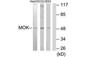 Western blot analysis of extracts from HepG2/COLO205/293 cells, using MOK Antibody.