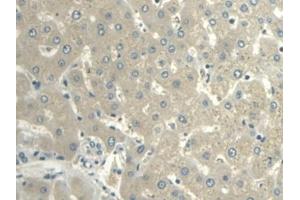 Detection of VF in Human Liver Tissue using Polyclonal Antibody to Visfatin (VF) (NAMPT 抗体  (AA 1-491))