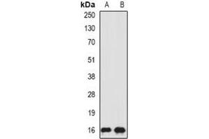 Western blot analysis of SRP19 expression in HepG2 (A), MCF7 (B) whole cell lysates. (SRP19 抗体)