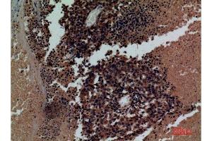 Immunohistochemistry (IHC) image for anti-Killer Cell Immunoglobulin-Like Receptor, three Domains, Long Cytoplasmic Tail, 3 (KIR3DL3) (Internal Region) antibody (ABIN6282363)