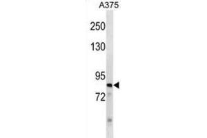 Western Blotting (WB) image for anti-Zinc Finger Protein 148 (ZNF148) antibody (ABIN3000952) (ZNF148 抗体)