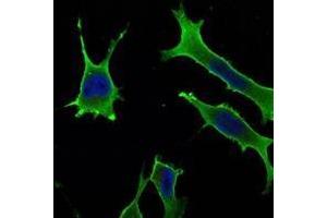 Immunofluorescence analysis of LOVO cells using Rab10 antibody (green). (RAB10 抗体)