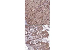 Immunohistochemical staining of human colon with TIGD7 polyclonal antibody  shows moderate cytoplasmic positivity in glandular cells. (TIGD7 抗体)