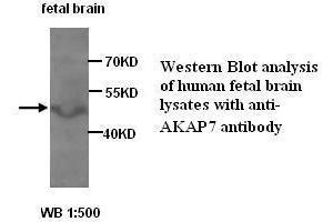 Image no. 1 for anti-A Kinase (PRKA) Anchor Protein 7 (AKAP7) antibody (ABIN1574566) (AKAP7 抗体)