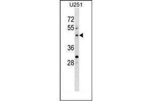 Western blot analysis of PLEKHO2 Antibody (N-term) in U251 cell line lysates (35ug/lane). (PLEKHO2 抗体  (N-Term))
