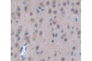 Used in DAB staining on fromalin fixed paraffin- embedded Kidney tissue (STK3 抗体  (AA 235-460))