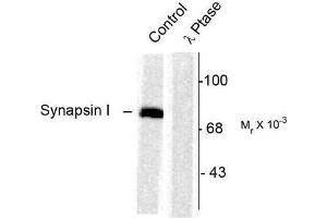 Image no. 1 for anti-Synapsin I (SYN1) (pSer603) antibody (ABIN372721) (SYN1 抗体  (pSer603))