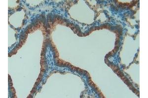 Detection of SFTPA1 in Rat Lung Tissue using Polyclonal Antibody to Pulmonary Surfactant Associated Protein A1 (SFTPA1) (Surfactant Protein A1 抗体  (AA 21-248))