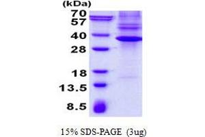 NK3 Homeobox 1 (NKX3-1) protein (His tag)