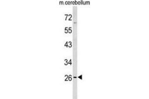 Western blot analysis of PXMP4 (arrow) in mouse cerebellum tissue lysates (35ug/lane) using PXMP4  (PXMP4 抗体  (Middle Region))