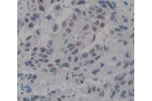 Used in DAB staining on fromalin fixed paraffin- embedded breast tissue (TDP1 抗体  (AA 4-215))
