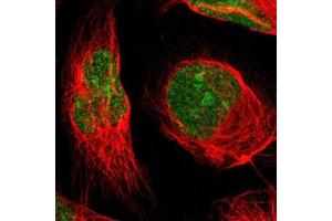 Immunofluorescent staining of U-2 OS with MINA polyclonal antibody  (Green) shows positivity in nucleus and nucleoli. (MINA 抗体)