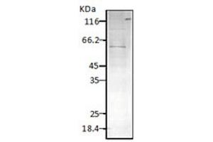 Western blot analysis of Parasite Lysates showing detection of HSP60 protein using Rabbit Anti-HSP60 Polyclonal Antibody . (HSPD1 抗体  (FITC))