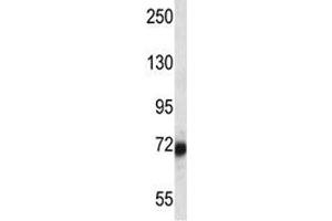SP100 antibody western blot analysis in ZR-75-1 lysate. (SP100 抗体  (AA 199-227))