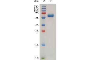 Human TNFA Protein, hFc Tag on SDS-PAGE under reducing condition.