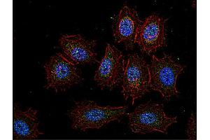 Immunocytochemistry staining of Csk in human HeLa cell line using anti-Csk (CSK-04, green). (CSK 抗体  (AA 330-450))