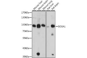 Western blot analysis of extracts of various cell lines, using SOG antibody (6597) at 1:1000 dilution.