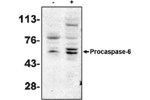Western Blotting (WB) image for anti-Caspase 6, Apoptosis-Related Cysteine Peptidase (CASP6) antibody (ABIN264405) (Caspase 6 抗体)