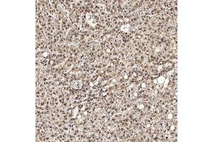 IHC analysis of U1A/SNRPA using anti-U1A/SNRPA antibody (ABIN7600891). (SNRPA1 抗体  (AA 25-218))