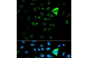 Immunofluorescence analysis of MCF-7 cells using CDKN1A Polyclonal Antibody (p21 抗体)