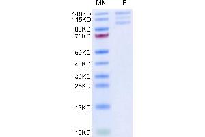 Biotinylated Human ITGAV&ITGB6 on Tris-Bis PAGE under reduced condition. (ITGAV/ITGB6 Protein (AA 31-992) (His-Avi Tag,Biotin))