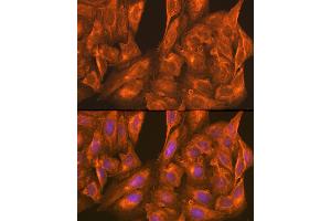 Immunofluorescence analysis of U-2 OS cells using PFKM Rabbit pAb (ABIN6132211, ABIN6145488, ABIN6145489 and ABIN6221141) at dilution of 1:100 (40x lens). (PFKM 抗体  (AA 501-780))