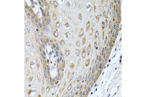 Immunohistochemistry of paraffin-embedded human esophagus using LRG1 antibody at dilution of 1:100 (40x lens). (LRG1 抗体)