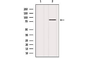 Western Blotting (WB) image for anti-Protein Kinase C, zeta (PRKCZ) (C-Term) antibody (ABIN6264247)