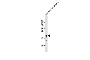 Anti-MLL2 Antibody  at 1:80000 dilution + recombinant protein whole cell lysate Lysates/proteins at 20 μg per lane. (MLL2 抗体  (C-Term))