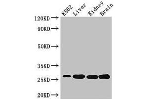 Western Blot Positive WB detected in: K562 whole cell lysate, Mouse liver tissue, Mouse kidney tissue, Mouse brain tissue All lanes: QDPR antibody at 3 μg/mL Secondary Goat polyclonal to rabbit IgG at 1/50000 dilution Predicted band size: 26, 23 kDa Observed band size: 26 kDa (QDPR 抗体  (AA 2-244))