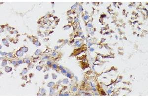 Immunohistochemistry (Paraffin-embedded Sections) (IHC (p)) image for anti-Galactosylceramidase (GALC) antibody (ABIN7260891)