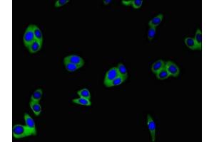 Immunofluorescent analysis of HepG2 cells using ABIN7147871 at dilution of 1:100 and Alexa Fluor 488-congugated AffiniPure Goat Anti-Rabbit IgG(H+L) (Claudin 1 抗体  (AA 24-161))