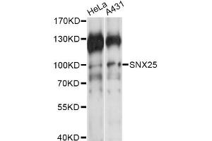 Western blot analysis of extracts of various cell lines, using SNX25 antibody (ABIN6291213) at 1:1000 dilution. (SNX25 抗体)