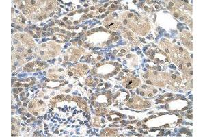 Image no. 1 for anti-Presenilin 2 (Alzheimer Disease 4) (PSEN2) (AA 101-150) antibody (ABIN6736670) (Presenilin 2 抗体  (AA 101-150))