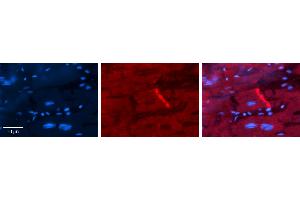 Rabbit Anti-CYBA Antibody   Formalin Fixed Paraffin Embedded Tissue: Human heart Tissue Observed Staining: Plasma membrane in intercalated disk Primary Antibody Concentration: 1:100 Other Working Concentrations: N/A Secondary Antibody: Donkey anti-Rabbit-Cy3 Secondary Antibody Concentration: 1:200 Magnification: 20X Exposure Time: 0. (CYBA 抗体  (Middle Region))