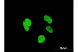 Immunofluorescence of monoclonal antibody to RAX on HeLa cell. (RAX 抗体  (AA 104-206))