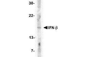 Western blot analysis of IFN-b in A-20 cell lysate with AP30401PU-N IFN-b antibody at 5 μg/ml. (IFNB1 抗体  (Center))