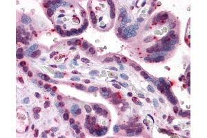 Anti-PRKG1 / CGKI antibody IHC of human placenta.