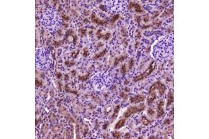 IHC testing of FFPE rat kidney tissue with PDGFRB antibody at 2 ug/ml. (PDGFRB 抗体  (AA 911-992))