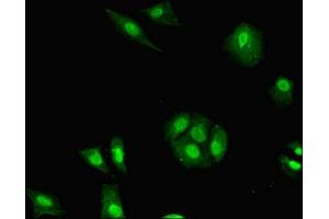 Immunofluorescent analysis of MCF-7 cells using ABIN7155373 at dilution of 1:100 and Alexa Fluor 488-congugated AffiniPure Goat Anti-Rabbit IgG(H+L) (H2AFB1 抗体  (AA 1-115))