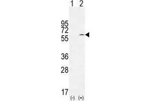 Western blot analysis of TIEG (arrow) using rabbit polyclonal TIEG Antibody (Center) . (KLF10/TIEG1 抗体  (Middle Region))