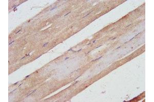 IHC image of ABIN7169503 diluted at 1:500 and staining in paraffin-embedded human skeletal muscle tissue performed on a Leica BondTM system. (SHARPIN 抗体  (AA 82-171))
