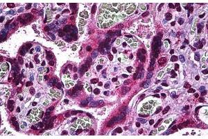 Human Placenta: Formalin-Fixed, Paraffin-Embedded (FFPE) (MAP2K3 抗体  (AA 1-100))