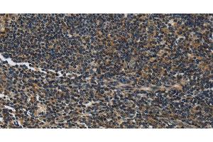 Immunohistochemistry of paraffin-embedded Human tonsil tissue using LGALS7 Polyclonal Antibody at dilution 1:50 (LGALS7 抗体)
