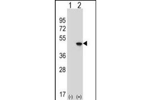 Western blot analysis of EIF4A2 (arrow) using rabbit polyclonal EIF4A2 Antibody (C-term) (ABIN653137 and ABIN2842713).