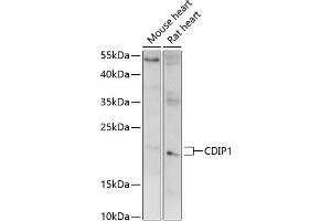 Western blot analysis of extracts of various cell lines, using CDIP1 antibody (ABIN7268288) at 1:1000 dilution. (CDIP1 抗体  (AA 100-200))
