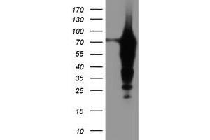 Western Blotting (WB) image for anti-Epsin 2 (EPN2) antibody (ABIN1498050) (Epsin 2 抗体)