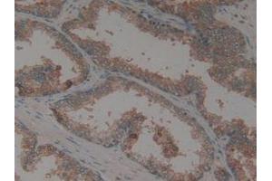 IHC-P analysis of Human Prostate Gland Tissue, with DAB staining. (CX3CL1 抗体  (AA 25-332))